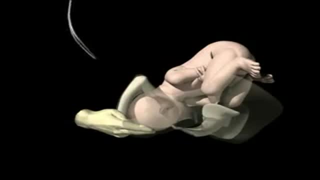 ⁣Forceps in Childbirth