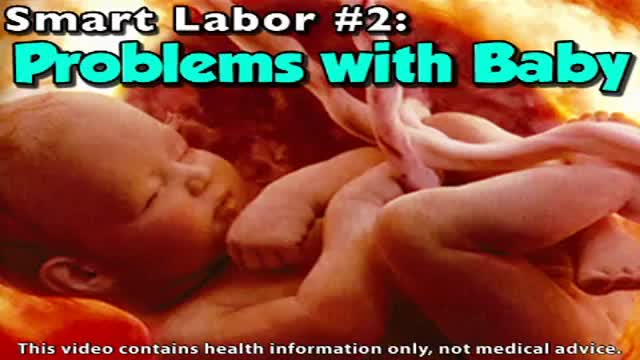 Breech Birth