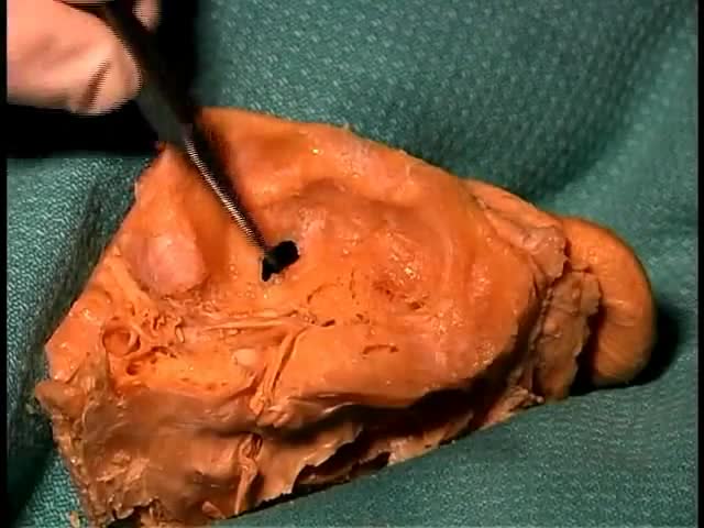 Anatomy of The Ear