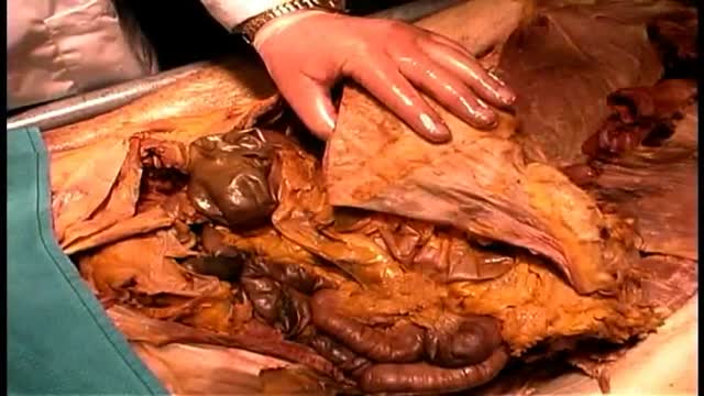 ⁣Anatomy of The Gastrointestinal Tract GIT
