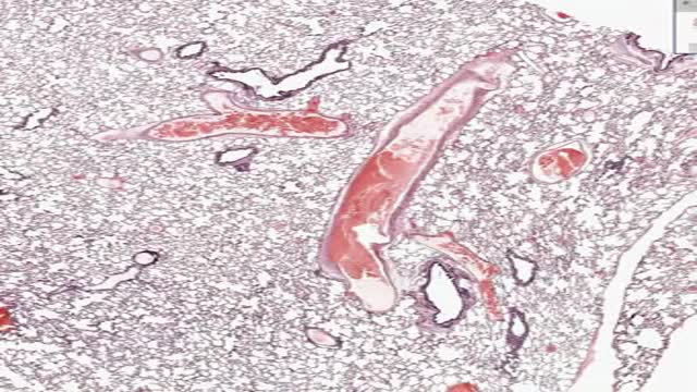 ⁣Histology of Lung