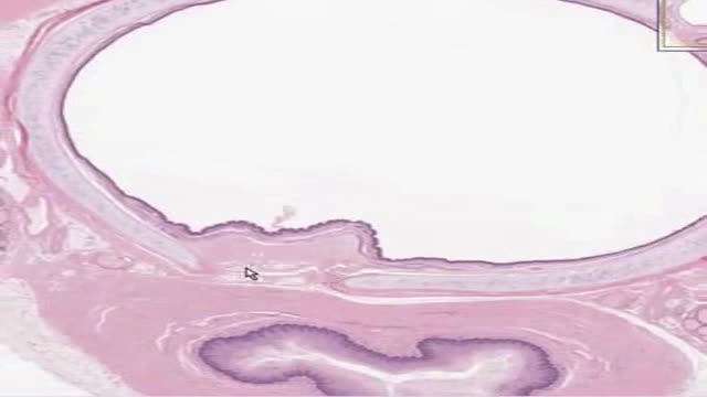 ⁣Histology of Trachea