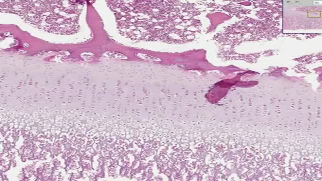 ⁣Histology of Endochondral Ossification