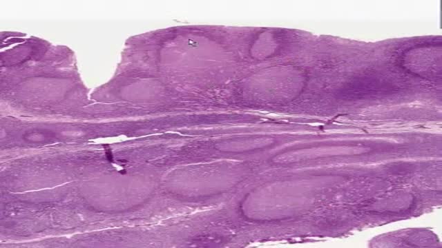⁣Histology of Pharyngeal Tonsil