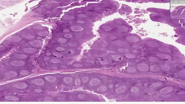 ⁣Histology of Palatine Tonsil