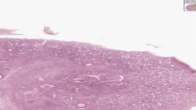 Histology of Ovary