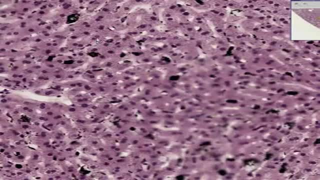 ⁣Histology of Liver Kupffer Cells