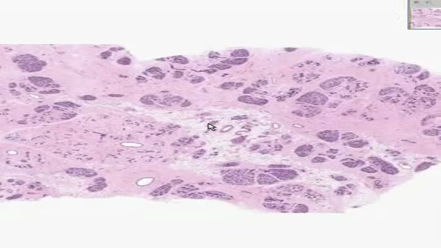Histology of Inactive Breast
