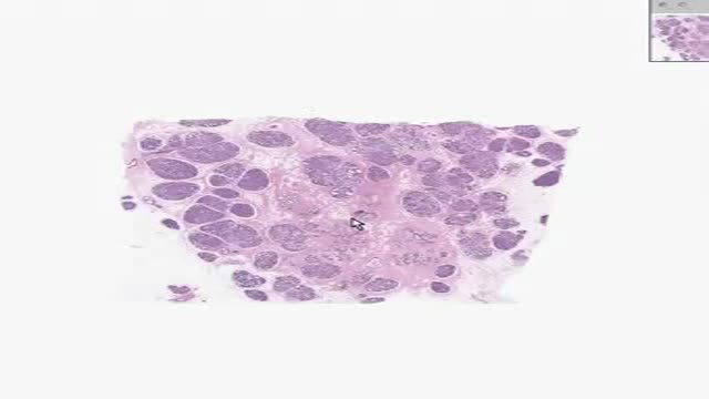 ⁣Histology of Active Breast