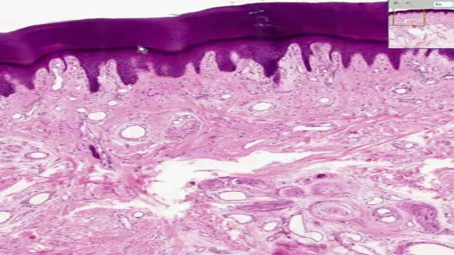 ⁣Histology of Thick Skin