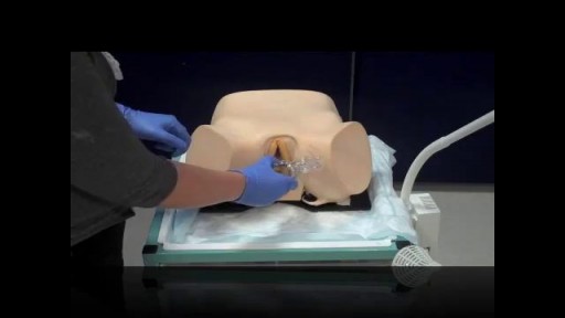Bimanual pelvic exam of a female