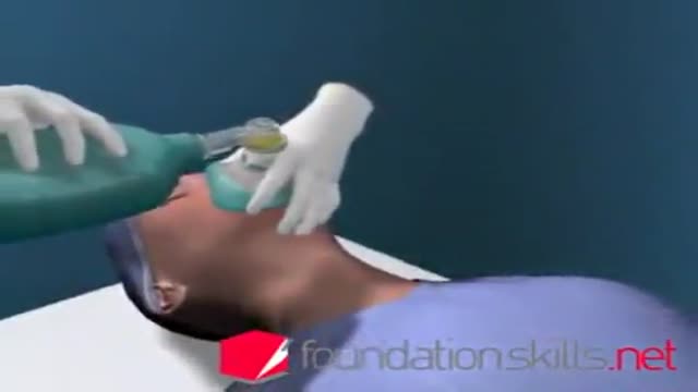 ⁣Intubation during General Anaesthesia 3D Animation