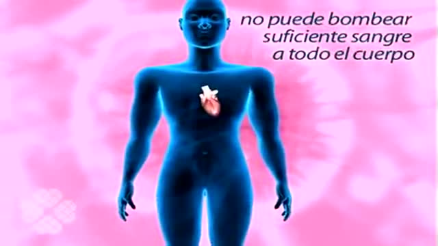 French Insuficiencia cardiaca
