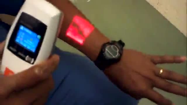 Infrared Vein Finder