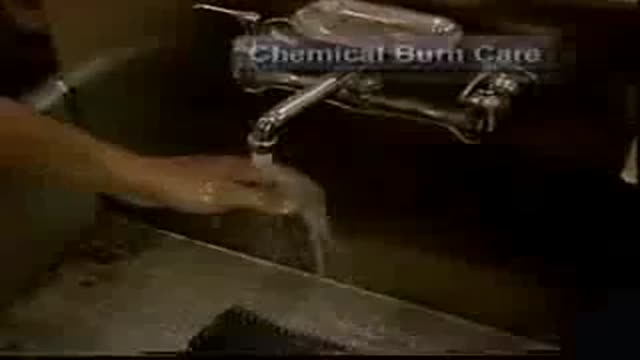 ⁣Chemical Burns