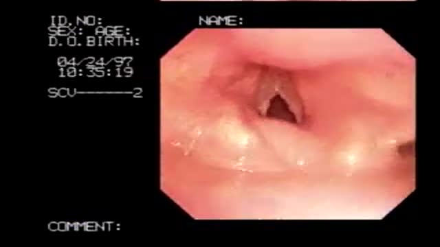 ⁣Fiberoptic Laryngoscopy and Bronchoscopy
