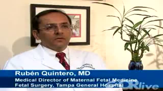 ⁣Fetal Laser Surgery