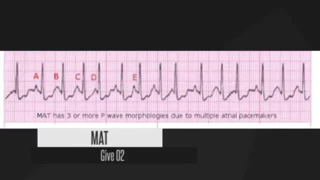 ⁣ECG rapid fire guide (medical.hints)