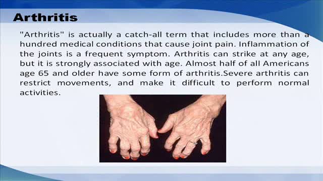 ⁣Common health concerns for seniors