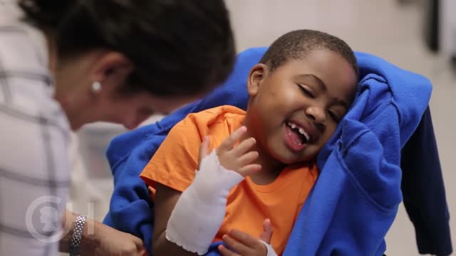 One Year Later: 	First Bilateral Hand Transplant in a Child