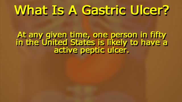 ⁣What Is A Gastric Ulcer?