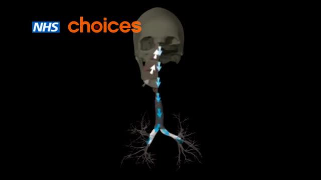 ⁣Bronchial Asthma