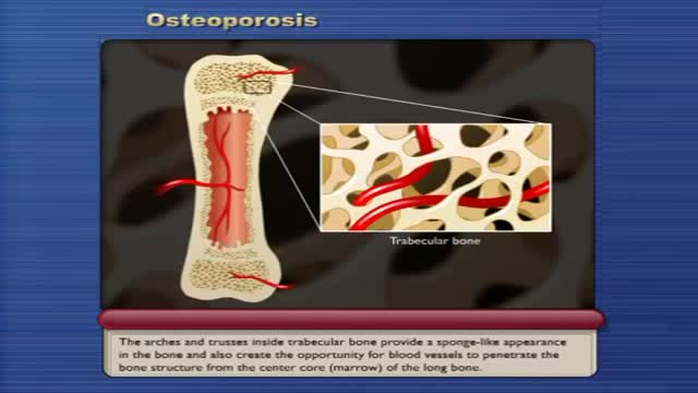 ⁣Osteoporosis and How to prevent it