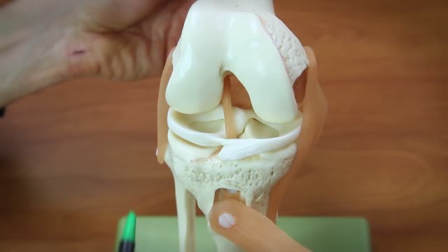 ⁣Arthroscopic Knee Surgery Meniscus Tear