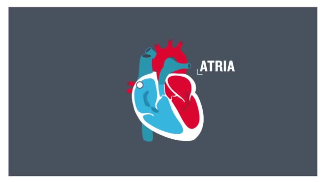 ⁣Atrial flutter