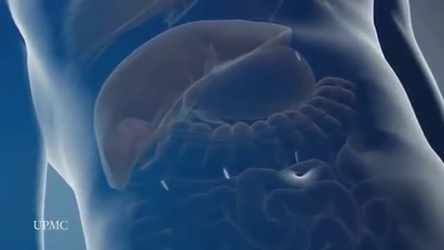 Laparoscopic Liver Surgery