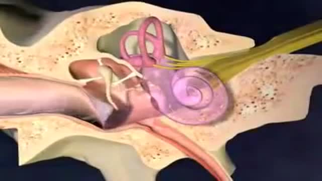 ⁣Otitis Media