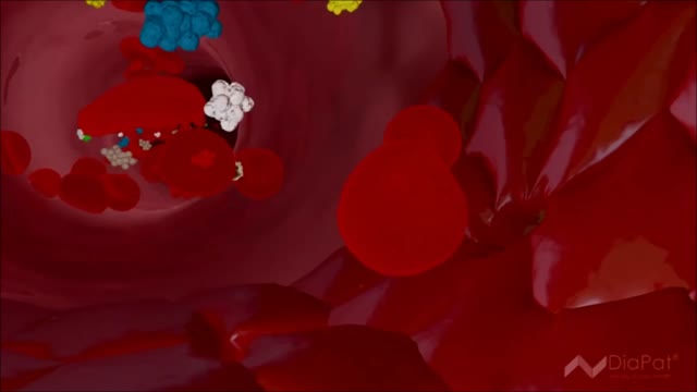 ⁣Treatment For Chronic Kidney Failure