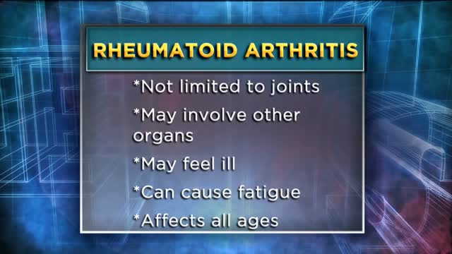 ⁣Arthritis