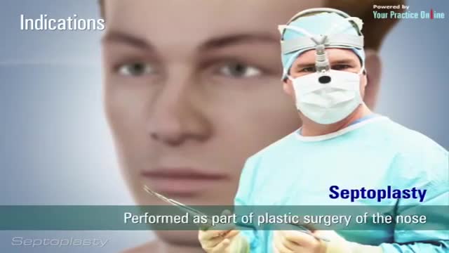 ⁣Septoplasty