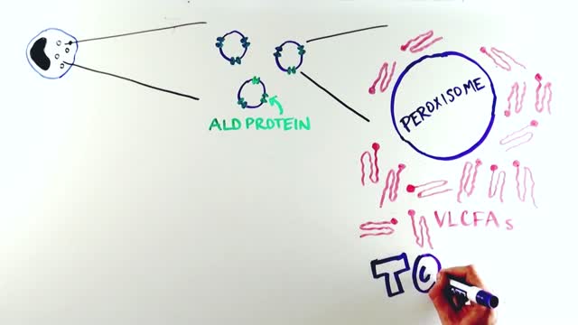 ⁣Adrenoleukodystrophy explained.