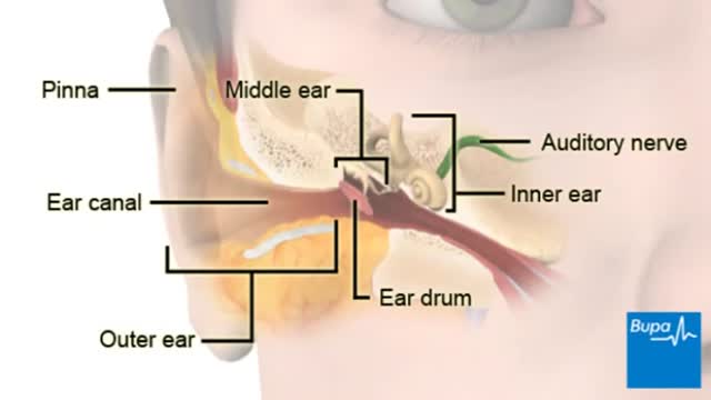 labyrinthitis