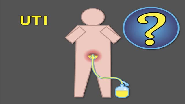 ⁣Catheter-Associated UTI Prevention