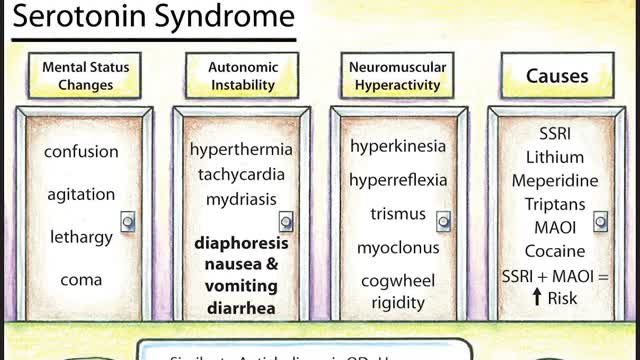 ⁣Serotonin Syndrome