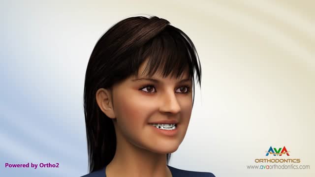 Different Types of Jaw Surgery