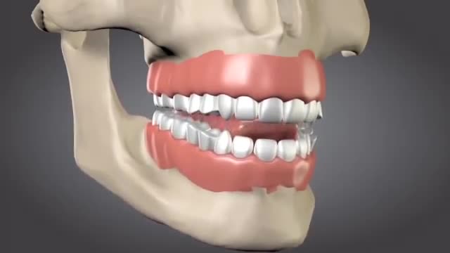Devastating Consequences of Tooth Loss