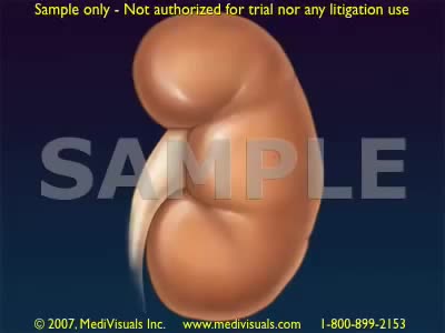 ⁣Kidney Function in Filtering Contrast