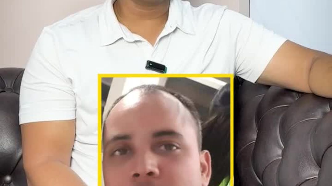 ⁣Hair Transplant Success Story - Dharam Raj Confidence Journey!