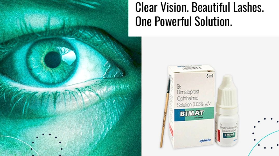 Handle The Problem of Glaucoma Effectually With Bimat 3ml