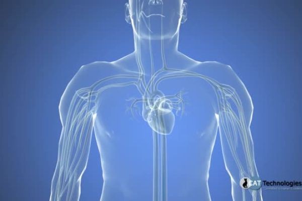 How Is a Coronary Angiogram Done?